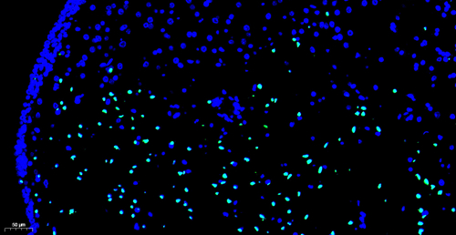 Kit de detección de apoptosis de células de tono CF488 TDT mediada por dutp Nick Etiquetado