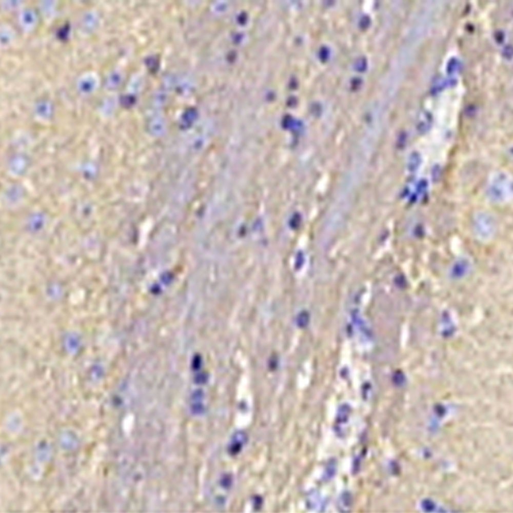 Anti -GAP43 Rabbit Pab Neurodearrollopmental Inmunoblotting