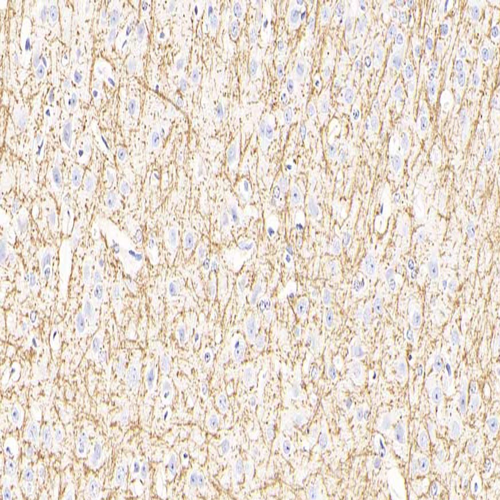 GB11226 anti -mielín proteico básico conejo pab