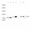 GB11404 Anti -alfa-Synuclein Rabbit Pab